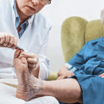 foot care treatment by nurse